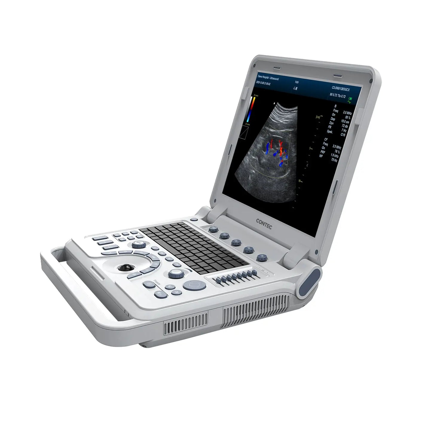 VET Veterinary Portable Ultrasound Scanner Laptop Machine Color Doppler For Pregnancy In Animals CJDropshipping