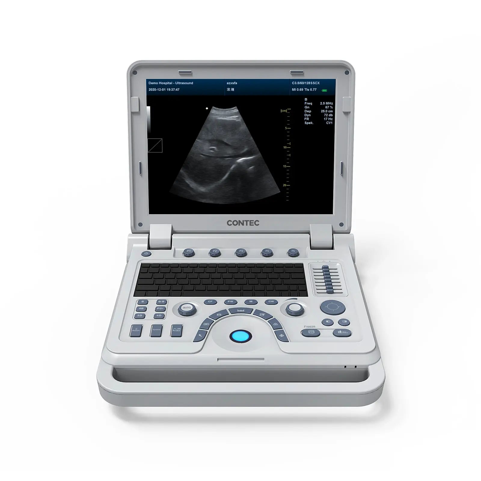 VET Veterinary Portable Ultrasound Scanner Laptop Machine Color Doppler For Pregnancy In Animals CJDropshipping